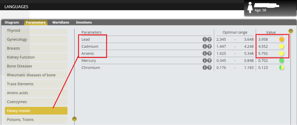 Snapshot from EWS Analyzer software showing heavy metal imbalances in a 58-year-old woman, including lead, cadmium, and arsenic.